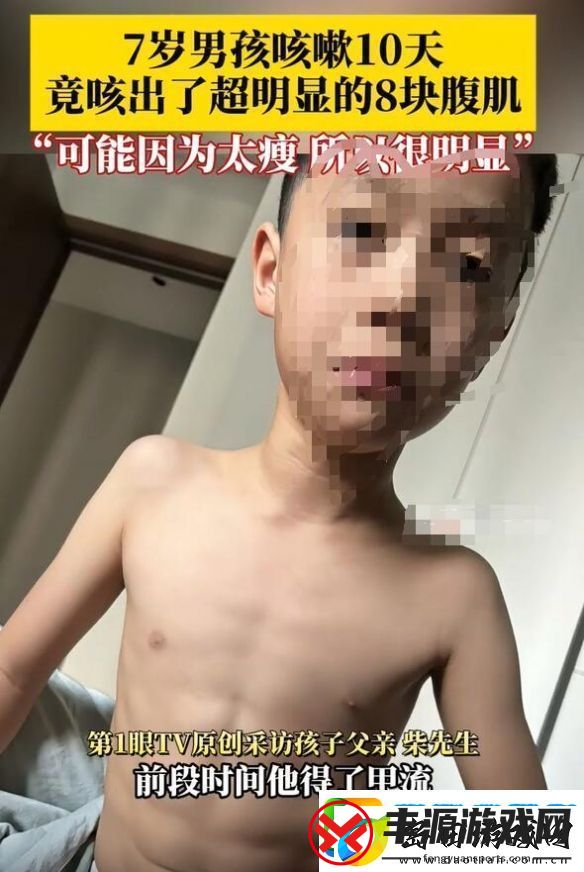 7岁男孩咳嗽10天咳出8块腹肌