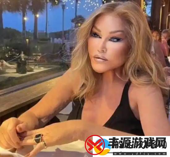 整容成“猫女”的瑞士名媛因心脏衰竭去世