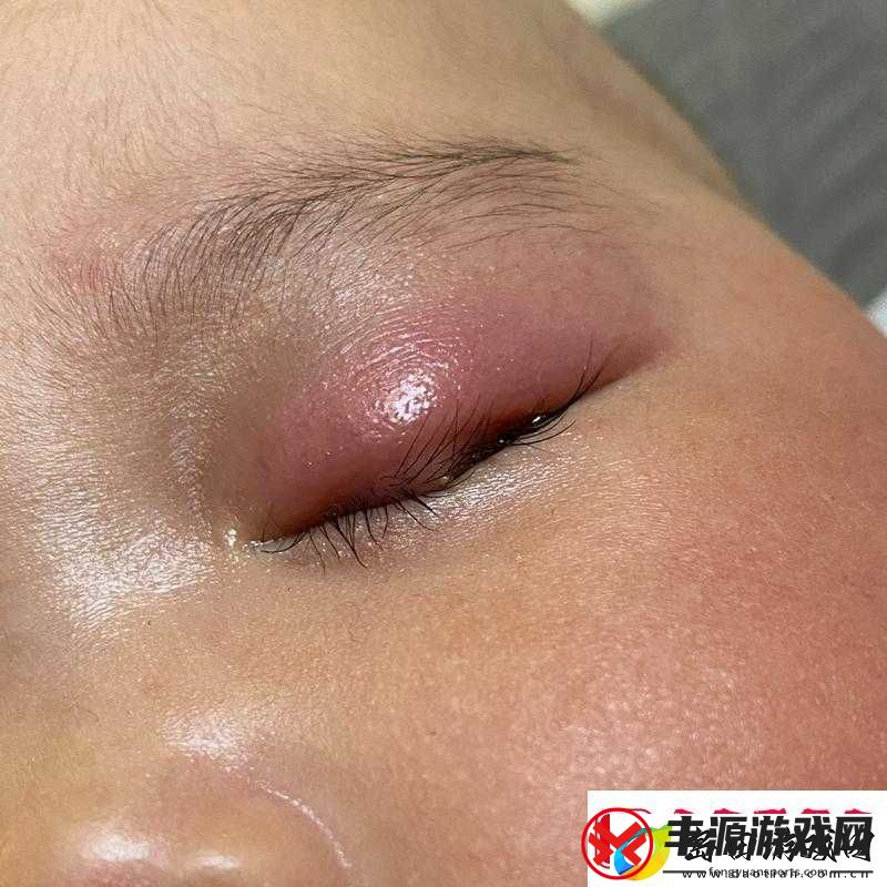 宝宝下面湿透且嘴硬喊疼令人揪心的特殊状况